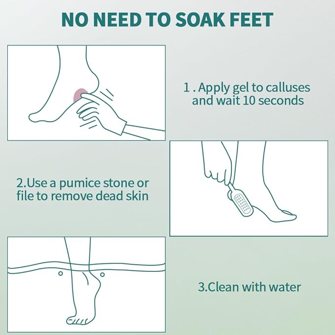 Gorgellux Callus Remover Gel, Callus Remover - Image 4