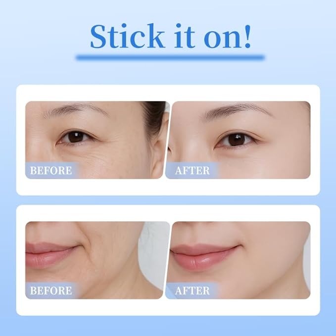 4 pairs PDRN Micro Eye Patches, Under Eye Patches - Image 7