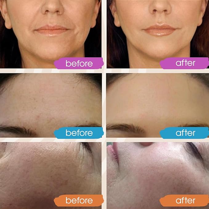 GLEOW Retinol Serum for Face - Image 3