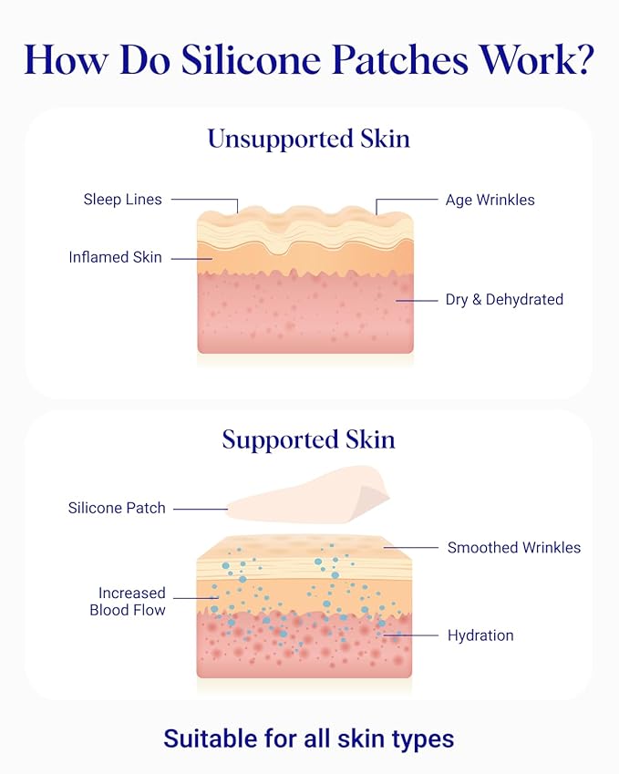 Wrinkles Schminkles Under Eye Wrinkle Patches, Smooth Eye Wrinkles, Crows Feet - Image 4