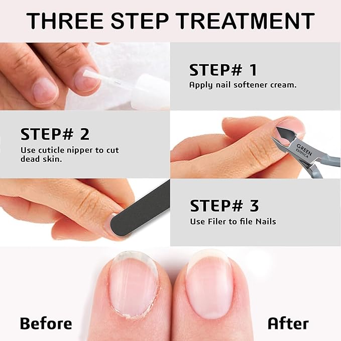 Professional Cuticle Trimmer Nail Cuticle Cutter Stainless Steel Cuticle Nippers - Image 7