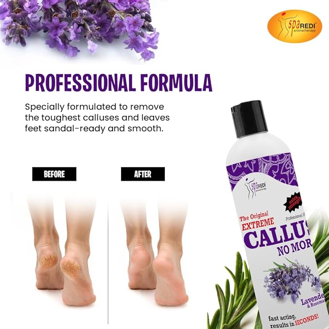 SPA REDI Callus Remover - Image 6