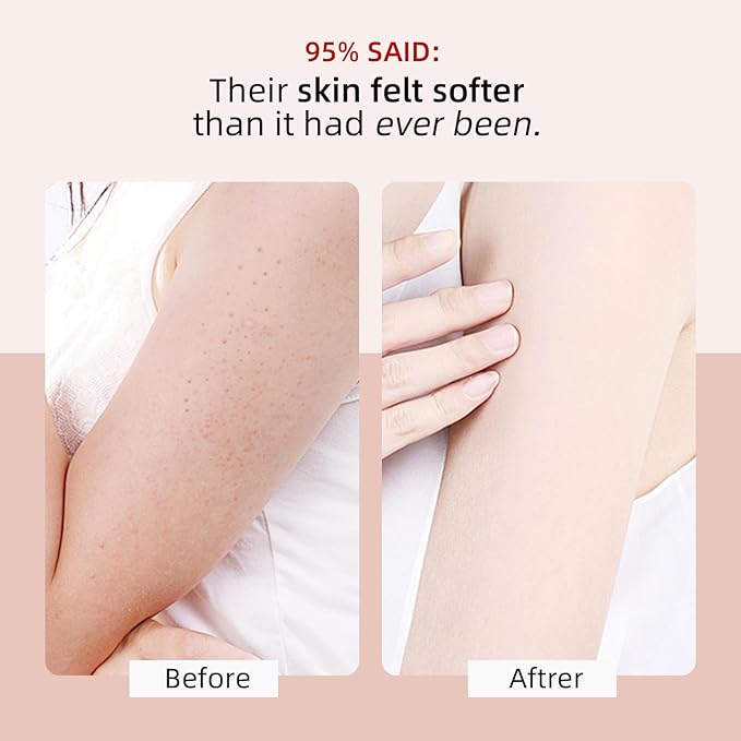 KP Bump Eraser Body Scrub with 10% AHA BHA Ingrown Hair Keratosis Pilaris Razor - Image 2