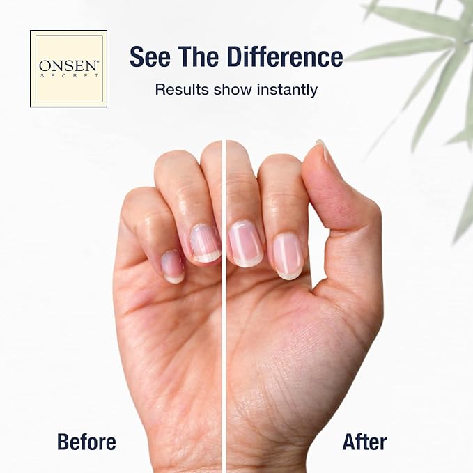 Onsen Japanese Nail File Buffer Sparkle-KIT 1.0, A Free 120/180 Grit Nail File - Image 2