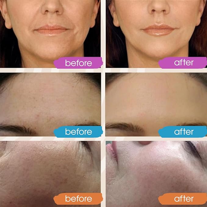 GLEOW Retinol Serum for Face, Vitamin C - Image 4
