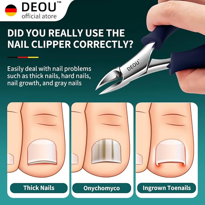 DEOU Podiatrist Toenail Clippers Ingrown Toenail Tools - Image 2