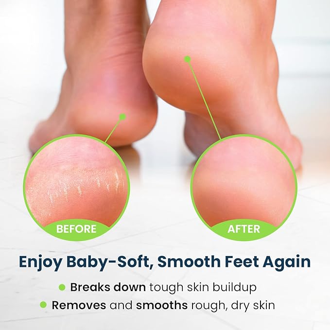 Toenail Fungus Treatment Extra Strength - Image 8