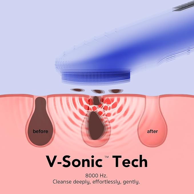 NågraCoola CLIE Facial Cleansing Brush, Waterproof and Rechargeable Face Scrub - Image 2