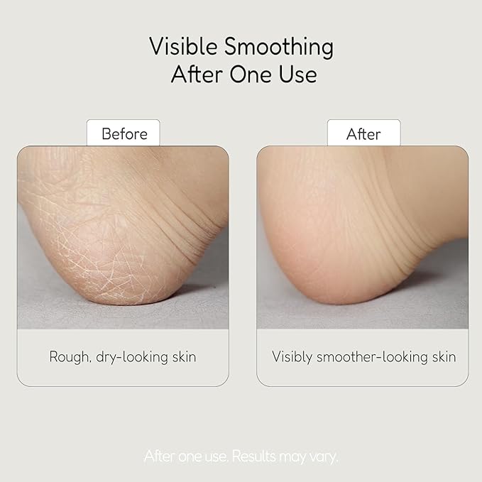 BUFFOUT Callus Eraser Exfoliating Gel – Body Care Exfoliator Scrub & Exfoliant - Image 4
