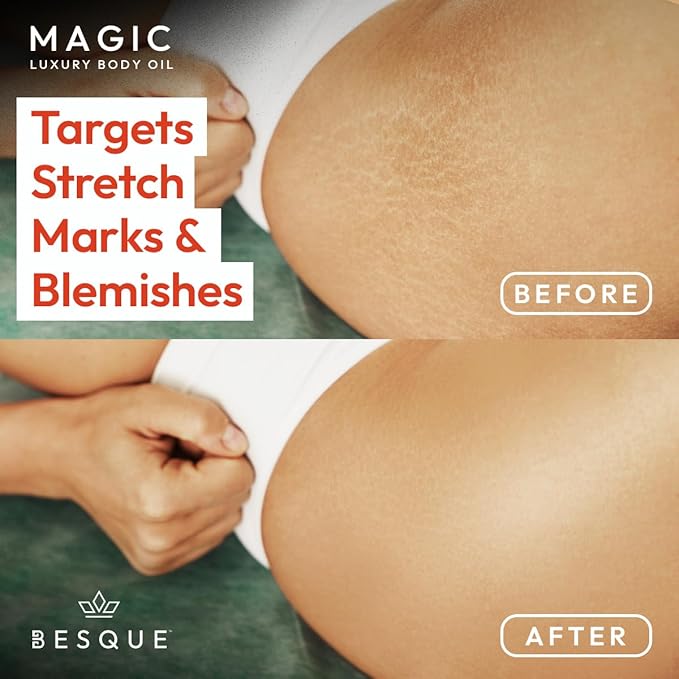 Besque Magic Body Oil, 3.4 FL OZ, After Shower Body Oil - Image 6
