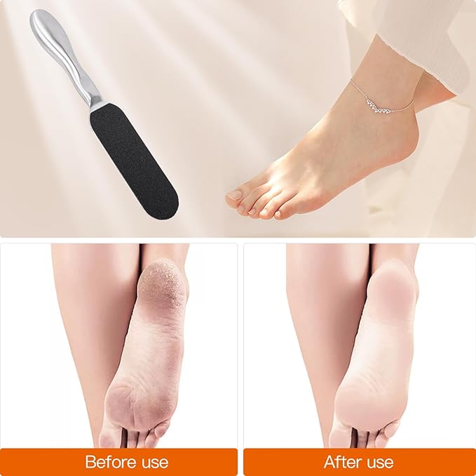 Biutee Foot File for Dead Skin Pedicure Foot Files Callus Remover Professional - Image 5