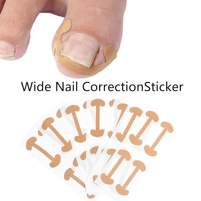 Ingrown Toenail Corrector Set - Image 4