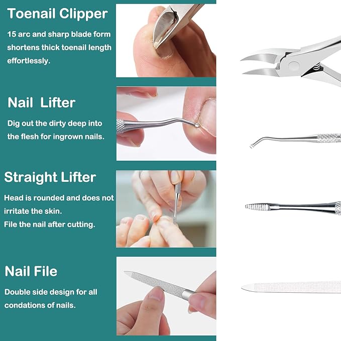 Ingrown Toenail Removal Kit Pedicure Tools - Image 7