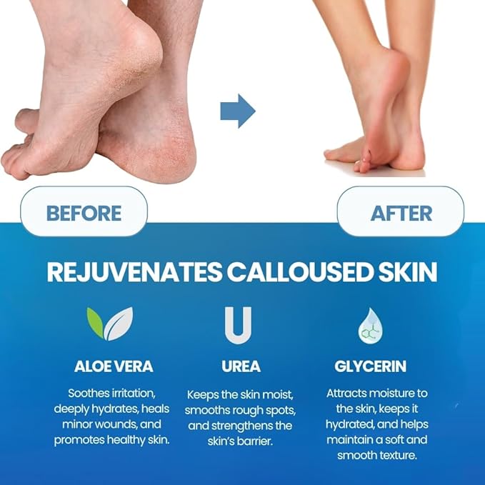 Imperial Feet Callus Softener Spray - Image 7
