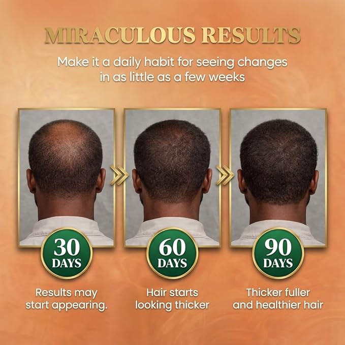 Batana Oil for Hair Growth Dr Sebi, 100% Raw Organic Batana Hair Mask from - Image 5