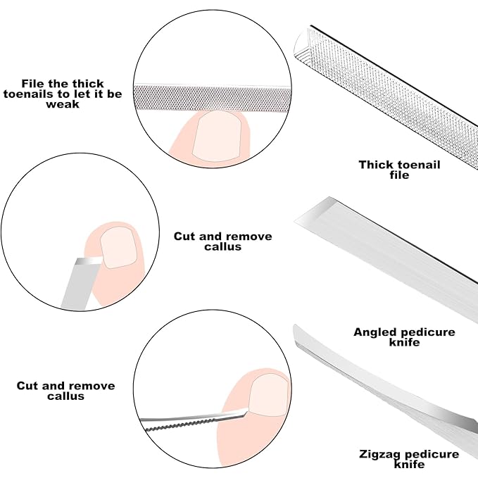 ZIZZON 7 Pcs Ingrown Toenail File and Lifters Set, Stainless Steel Ingrown - Image 6