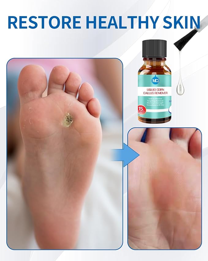 MQ Professional Corn & Callus Remover Liquid - Image 5
