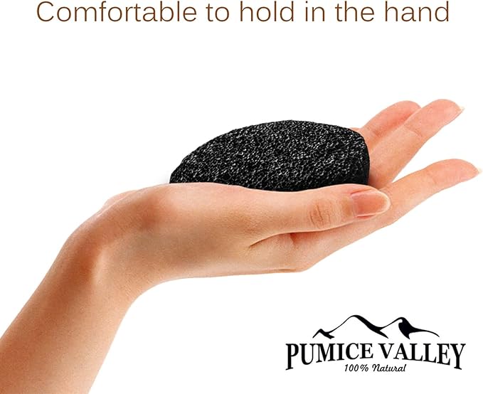 Pumice Stones for Feet - Image 5