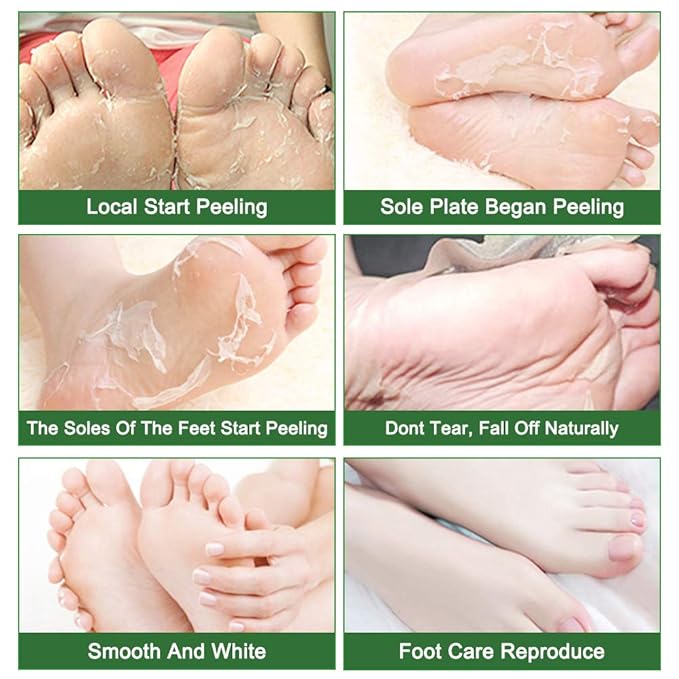 Liefiet Foot Peeling Mask 5 Pack, Foot Mask Remove Dead Skin, Rough Callus and - Image 2