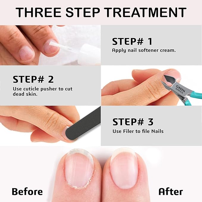 Professional Cuticle Trimmer Nail Cuticle Cutter Stainless Steel Cuticle Nippers - Image 8