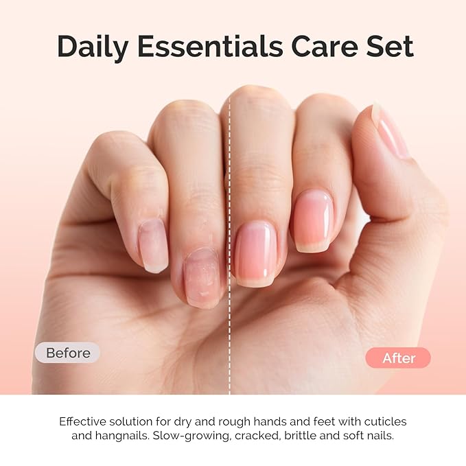 MelodySusie 25ML Cuticle Oil, Cuticle Nourishes, Promotes Nail Growth and - Image 3