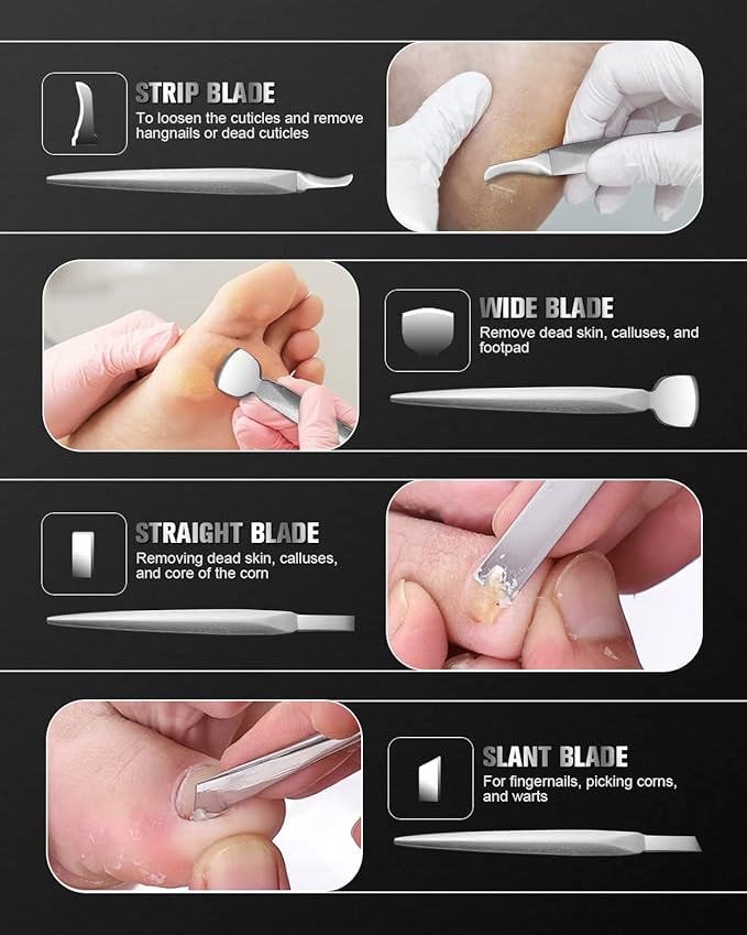 FERYES Pedicure Knife Ingrown Toenail Kit, Top Notch Foot Blade, Super Sharp - Image 4