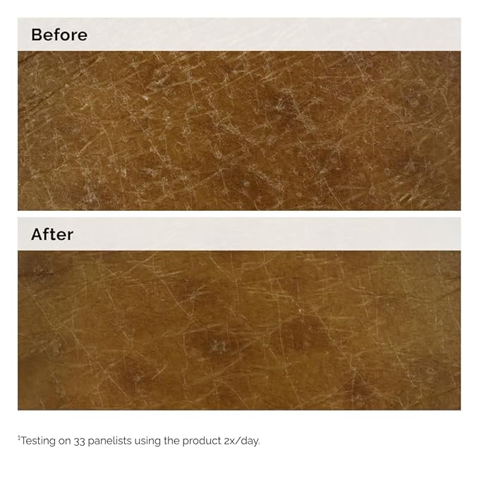 The Ordinary Natural Moisturizing Factors + Inulin Body Lotion, Lightweight - Image 7