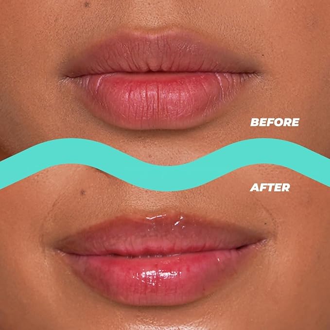 Vitamasques Lip Butter Balm - Image 2