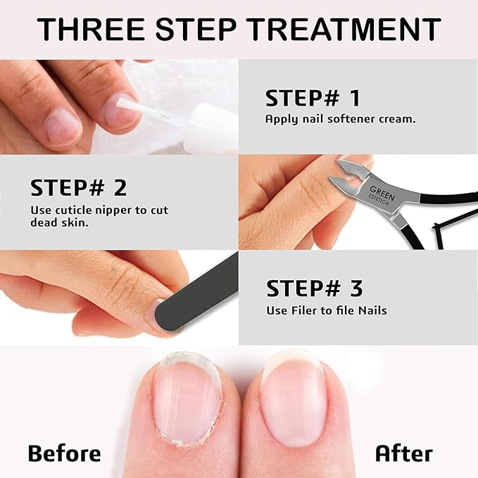 Professional Cuticle Trimmer Nail Cuticle Cutter Stainless Steel Cuticle Nippers - Image 5