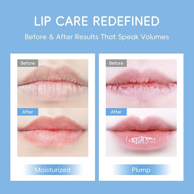 AKARY Milk Hydrating Lip Mask Gels - Image 6