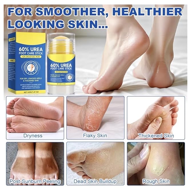 60% Urea Cream Stick with 2% Salicylic Acid, Maximum Strength Foot Care Balm - Image 7