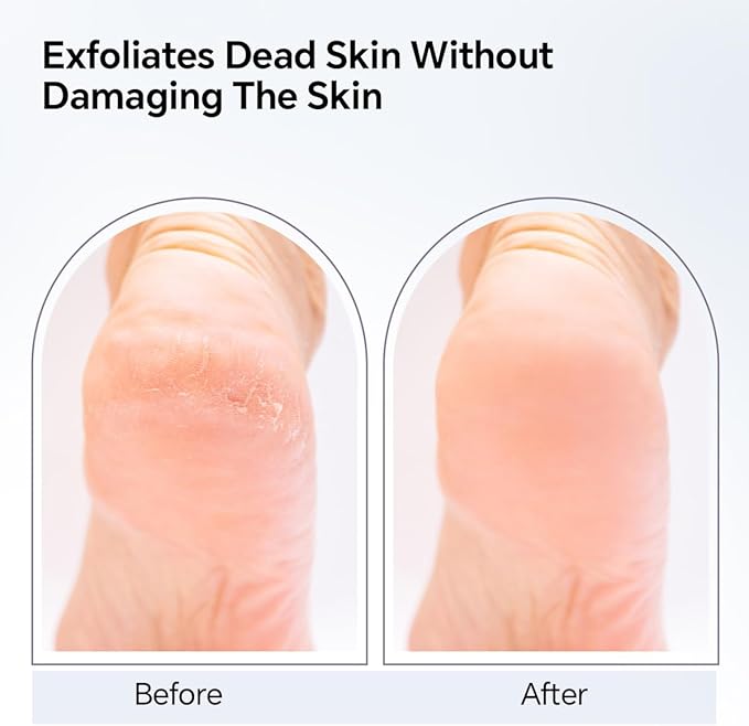 Nano Glass Foot File, Foot Callus Remover, Double Sided Pedicure Tools - Image 5