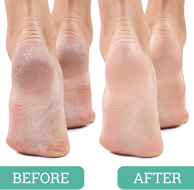 Maccibelle Salon Foot Pumice and Scrubber - Image 3