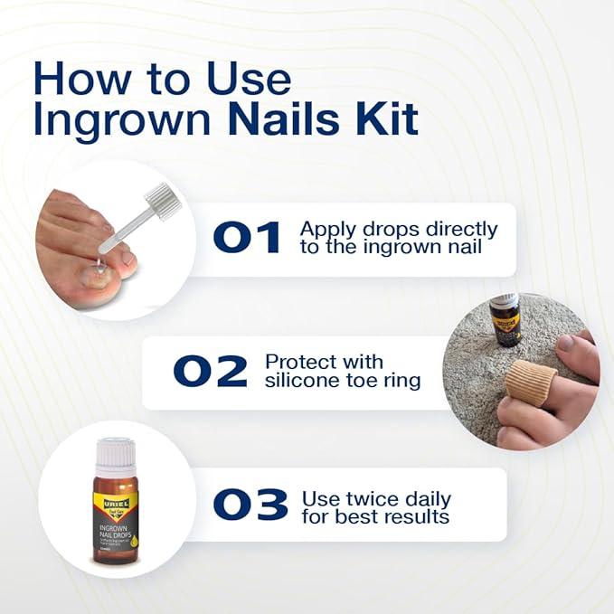 URIEL UPGRADED Ingrown Toenail Treatment - Image 5