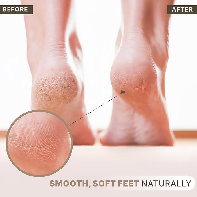 Beauty by Earth Pumice Stone for Feet - Image 2