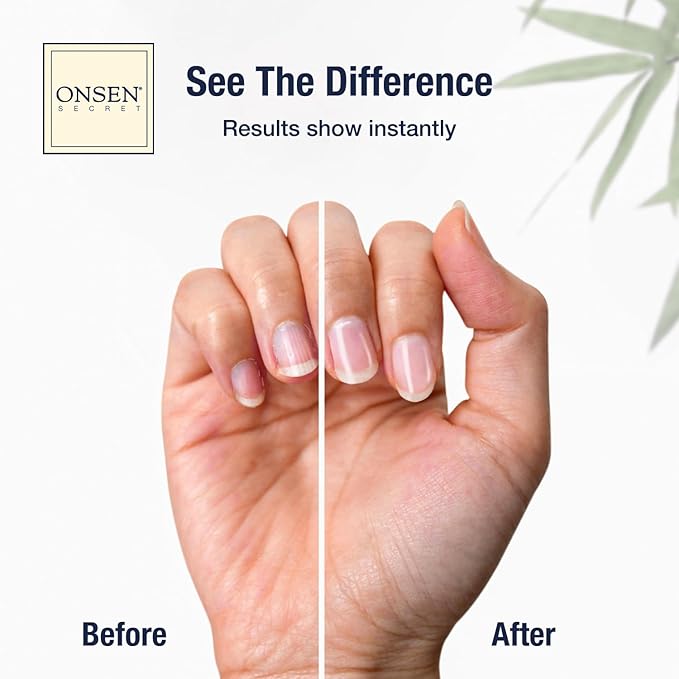 Onsen Secret Ultimate Nail Reboot Kit - Image 2