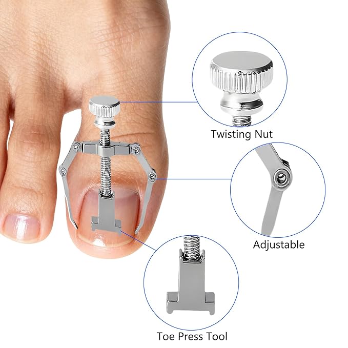 Professional Ingrown Toenail Correction Kit - Image 5
