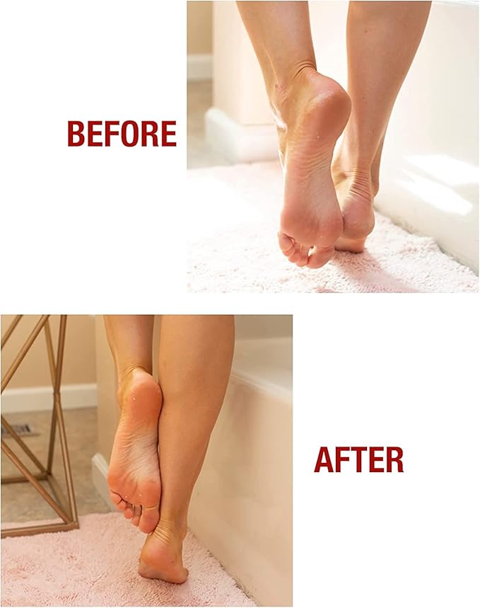 Kerasal Intensive Foot Repair Skin Healing Ointment, 1 Oz and Moisturizing Gel - Image 4