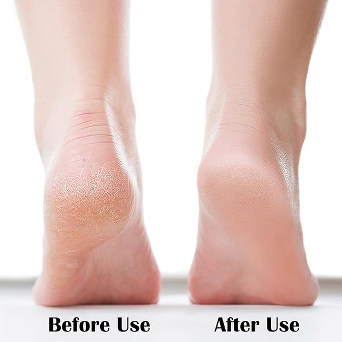 Nano Foot File, Foot Scrubber Callus Remover, Foot Care Pedicure Tool, Foot File - Image 3