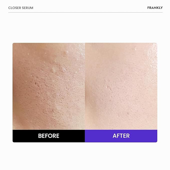 FRANKLY Closer Serum Jumbo | Pore Minimizer Serum | 9 Peptides, Vegan Collagen - Image 2