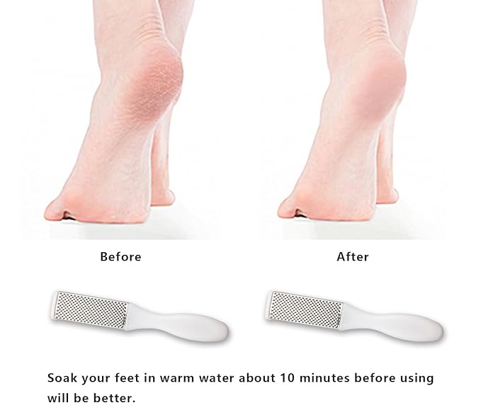 Professional Foot Files Callus Remover, Foot Scrubber - Image 4