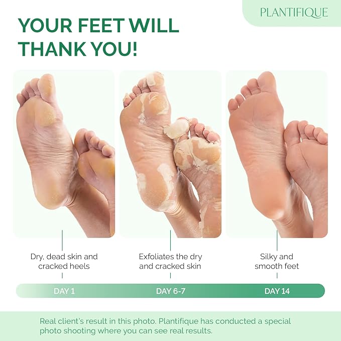 PLANTIFIQUE Foot Peeling Mask - Image 2
