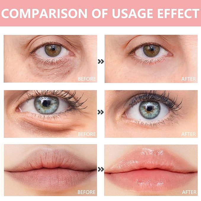 30 Pairs Lip Mask & Eye Mask, Under Eye Patches - Image 7