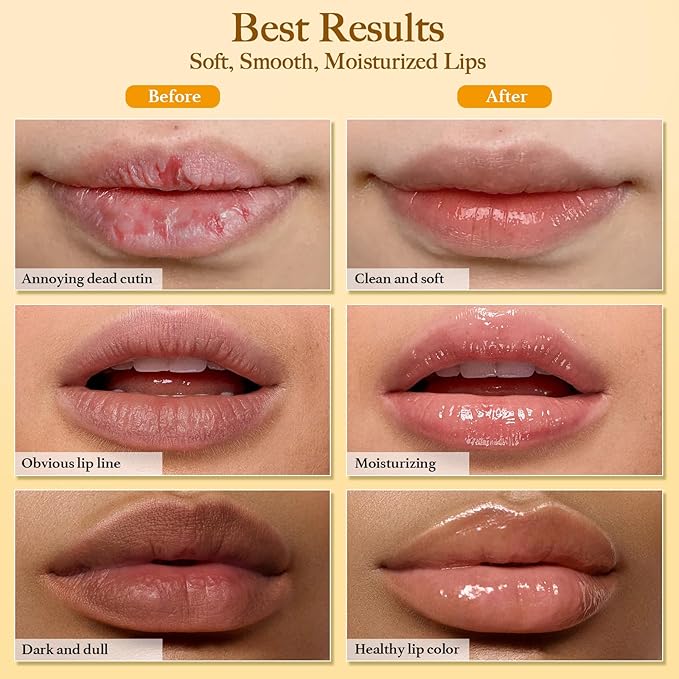 3PCS Turmeric Lemon Lip scrub and Turmeric Lip Balm - Image 5