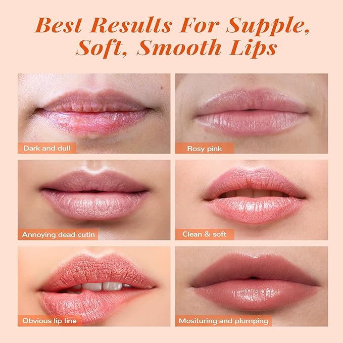 ANAI RUI Lip Scrub & Mask Set, Lip Scrubber Exfoliator, Lip Sugar Scrub - Image 6