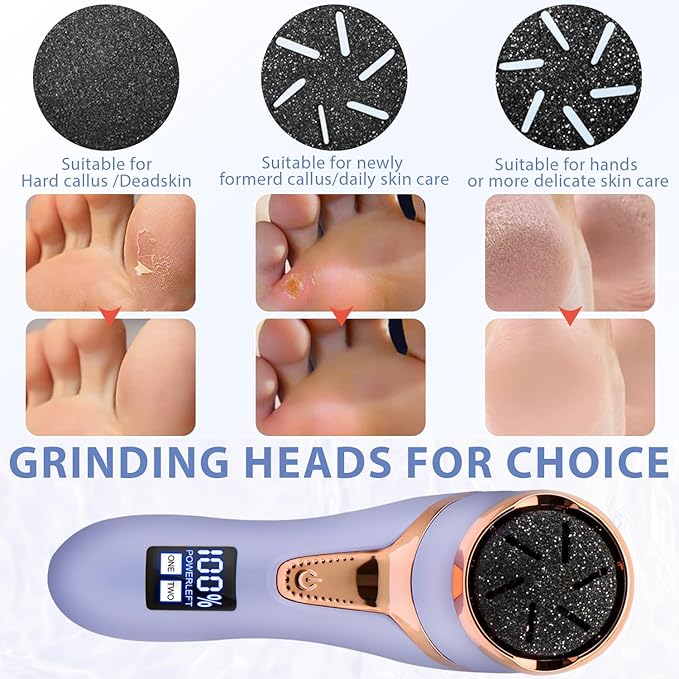 Electric Callus Remover for Feet, Portable Pedicure Kit Foot File Callus Remover - Image 7