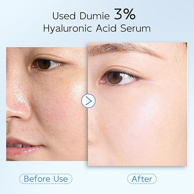 3% Hyaluronic Acid Serum for Face, Anti-Aging Hydrating Serum - Image 7