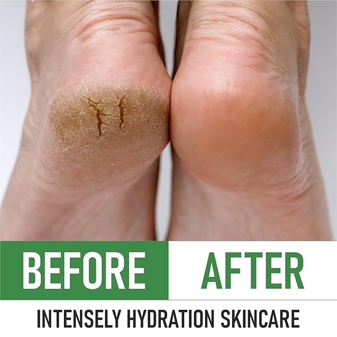 PurOrganica Urea Cream 40% – Made in USA, Maximum Strength Foot Cream - Image 6
