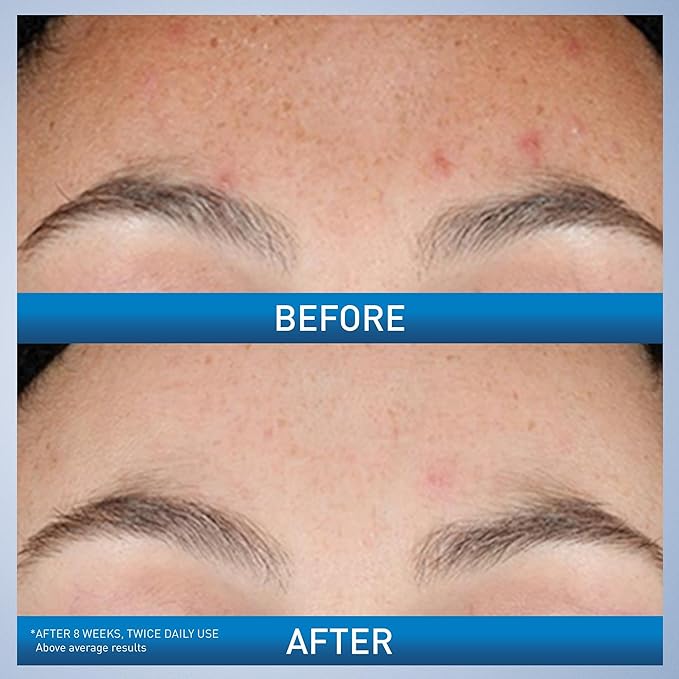 CeraVe Resurfacing Retinol Serum - Image 3