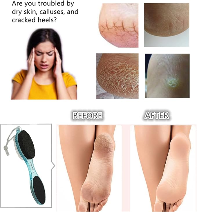 Foot File Callus Remover 4-in-1, Feet Scraper Pedicure Tools - Image 3